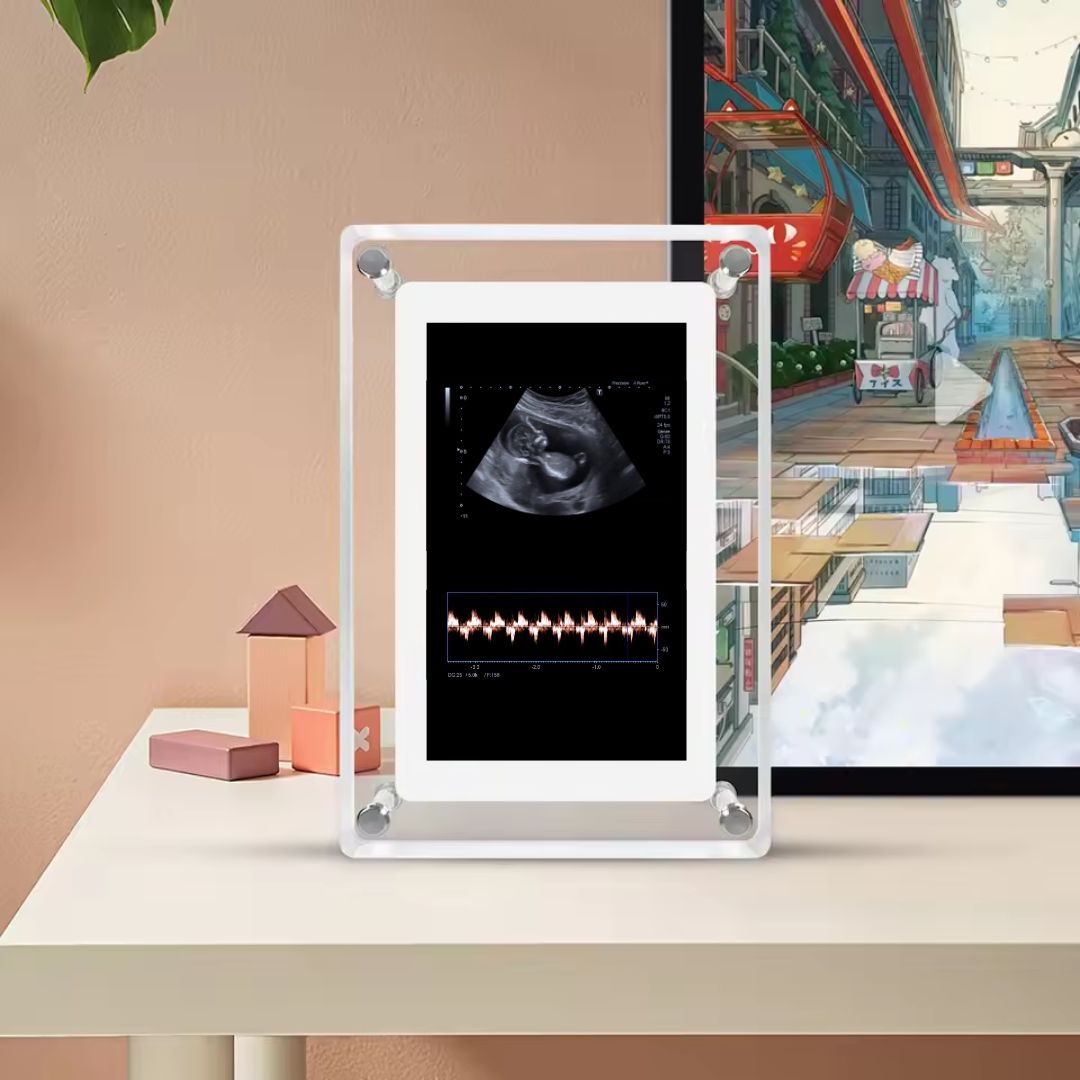 Memory Frame